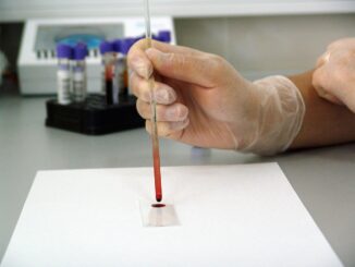 Wissenschaft: Blutuntersuchungen in der Medizintechnik